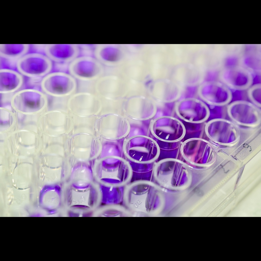 Psize:P38MAPK elisa kit :: Bovine Phosphorylation P38 Mitogensize:activated Protein Kinase ELISA Kit size: 96size:Stripsize:Wells